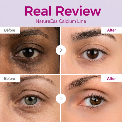🔥LAST DAY 50% OFF!! NatureEss Korean Calcium Dark Spot Eye Cream