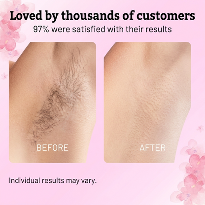 🔥Final 3 Hours: 70%OFF🌿Beauty Cyperus Rotundus Oil:🎁 The Ultimate Natural Solution for Smooth, Healthy Skin